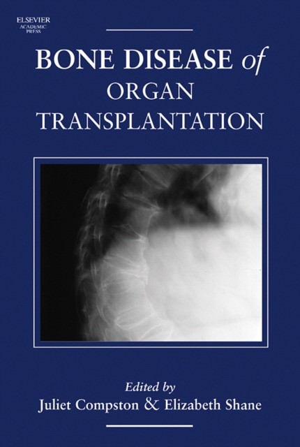 Juliet Compston Bone Disease of Organ Transplantation, 