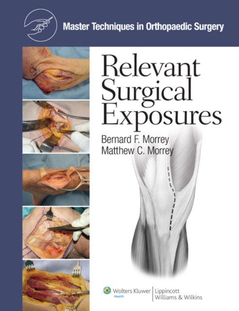 Morrey Master Techniques in Orthopaedic Surgery: Surgical Exposures 