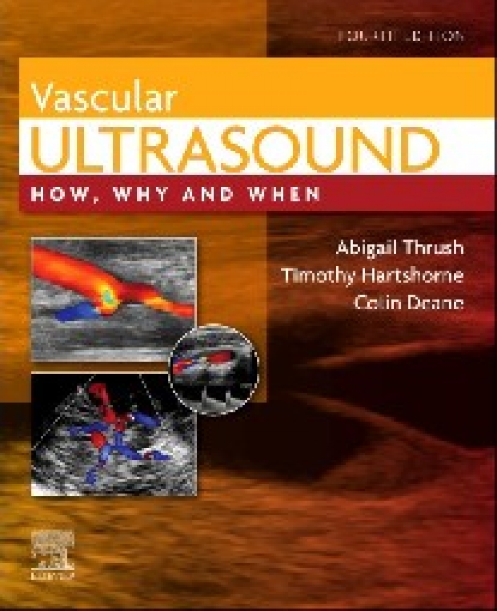 Vascular ultrasound 