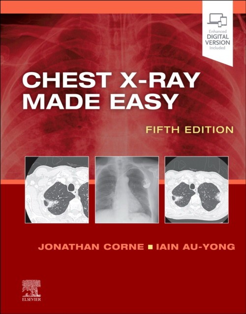 Jonathan, Ma, Corne Chest x-ray made easy 